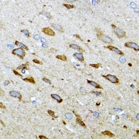 Anti-MT-ND5 Antibody