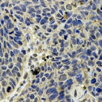 Anti-SCOT Antibody