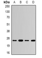 UCH-L3 Rabbit Polyclonal Antibody