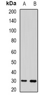 UPIb Rabbit Polyclonal Antibody