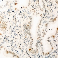 Anti-THOC1 Antibody
