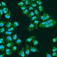 Anti-THOC1 Antibody