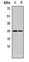Med6 Rabbit Polyclonal Antibody