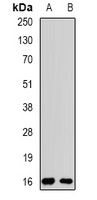 Rpp20 Antibody