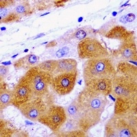 Anti-METTL7A Antibody