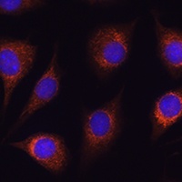 Anti-METTL7A Antibody