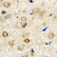 Anti-ATAD3A Antibody