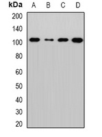 Sec5 Rabbit Polyclonal Antibody