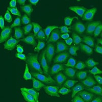 Anti-Sec5 Antibody