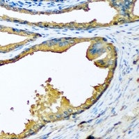 Anti-HPA2 Antibody