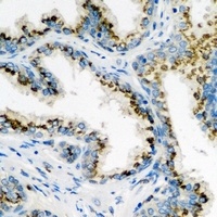 ARL6 Antibody