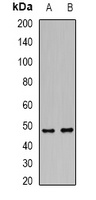 DCP2 Antibody