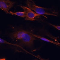 Anti-BAR Antibody