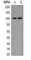 REP-1 Rabbit Polyclonal Antibody