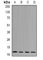 nm23-H4 Rabbit Polyclonal Antibody