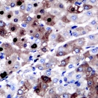 Anti-XPC Antibody
