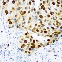 DDX39B Antibody