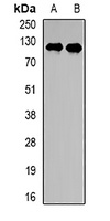 PPP6R2 Rabbit Polyclonal Antibody