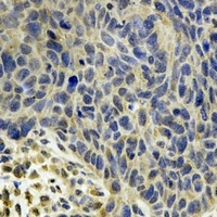 Anti-MsrB2 Antibody