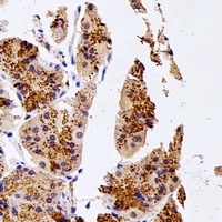 Anti-NUDT15 Antibody