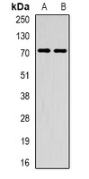 METTL3 Antibody