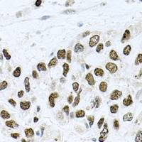 METTL3 Antibody