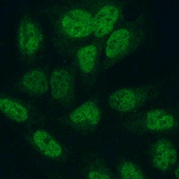 METTL3 Antibody