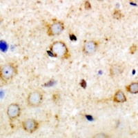 Anti-ANR52 Antibody