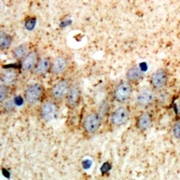 ABCB8 antibody