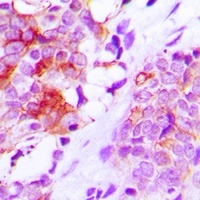 MRP1 Rabbit Polyclonal Antibody