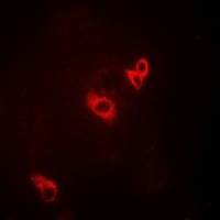 Anti-ACAD9 Antibody