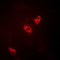 ACAD9 antibody