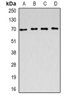 ACADVL Antibody