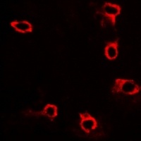 ACP5 antibody