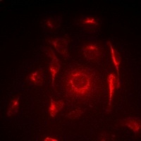 Anti-ACAS2 Antibody