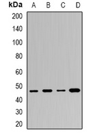 BAF53B Rabbit Polyclonal Antibody