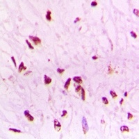 Anti-BAF53B Antibody