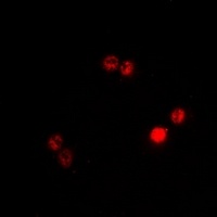 Anti-BAF53B Antibody