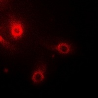 Aminoacylase 1 Rabbit Polyclonal Antibody