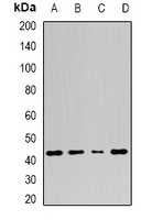 Adenosine Deaminase Rabbit Polyclonal Antibody