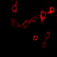 Adenosine Deaminase Rabbit Polyclonal Antibody