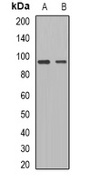 ADAM15 Rabbit Polyclonal Antibody
