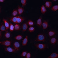 Anti-ADAM15 Antibody