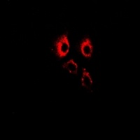 Anti-ADAM9 Antibody