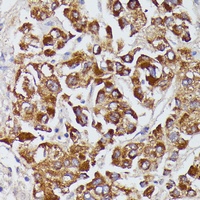 Angiotensinogen antibody