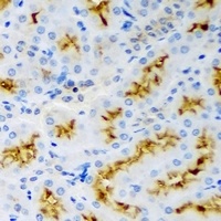 Anti-p43 Antibody