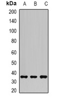 AKR1C3 Antibody