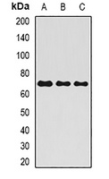ALPP Antibody