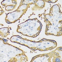Anti-ALPP Antibody