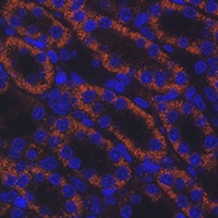 Anti-AMACR Antibody
